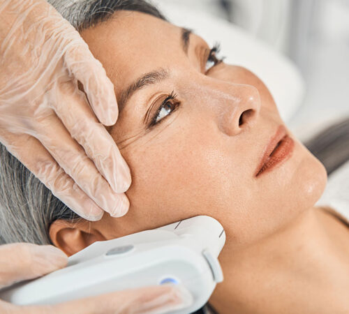 The-Radiance-Clinic-Services-HIFU-Non-Surgical-Facelift-Image
